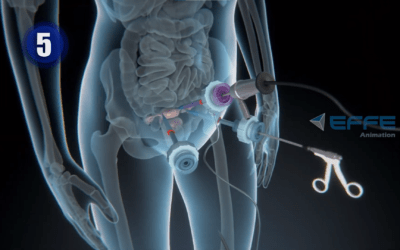 3D Medical Diagnostic Animation Video: Medical Animation Company