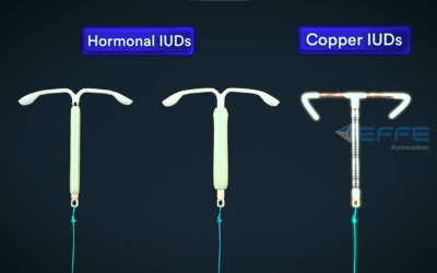 3D Animation Video of Intrauterine Device (IUD) | Medical Animation Services