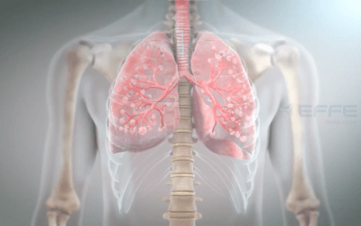 3D Pathology Animation Video for Medical Industry: Medical Animation Company