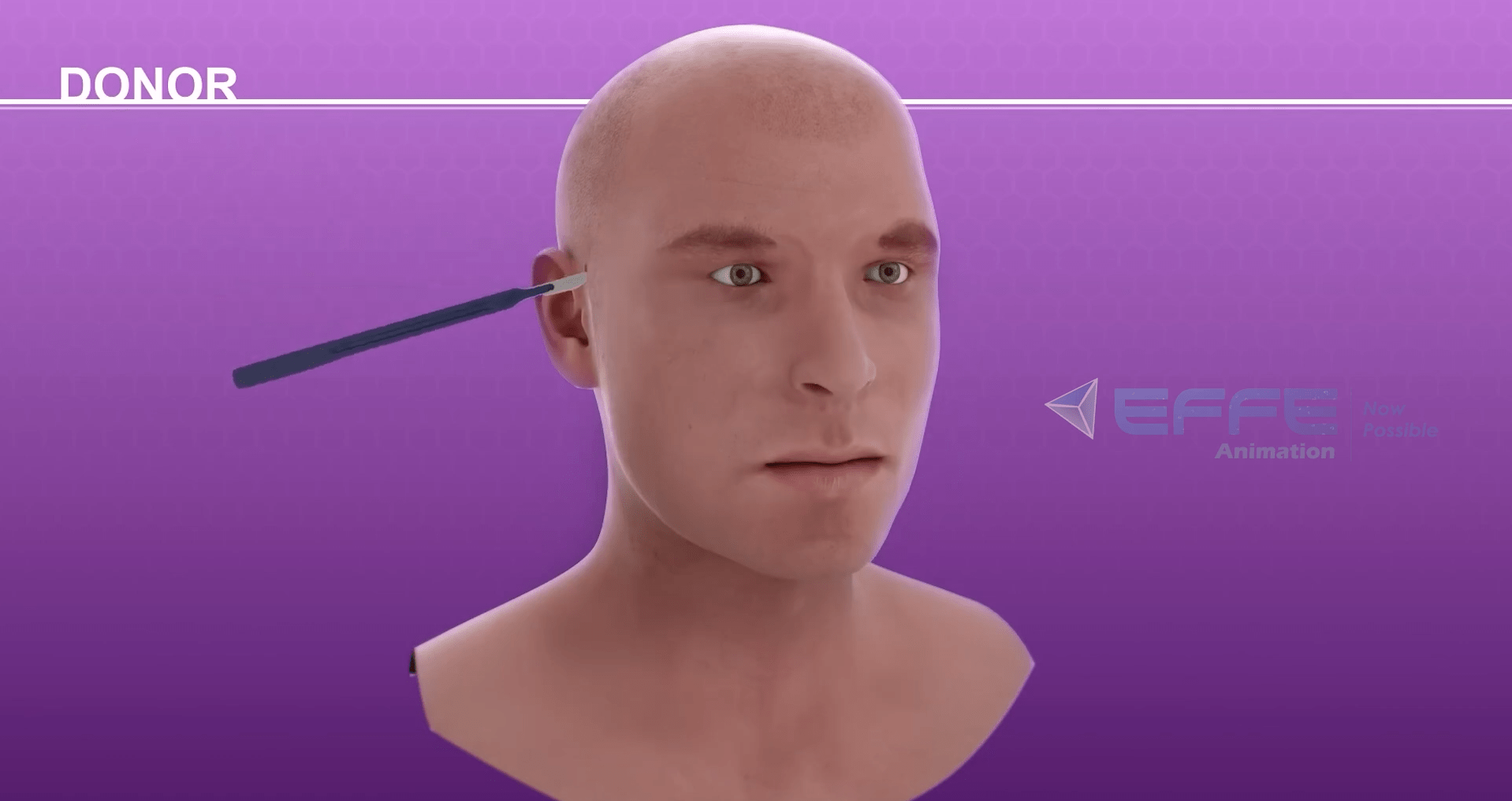 plastic surgery 3D animation