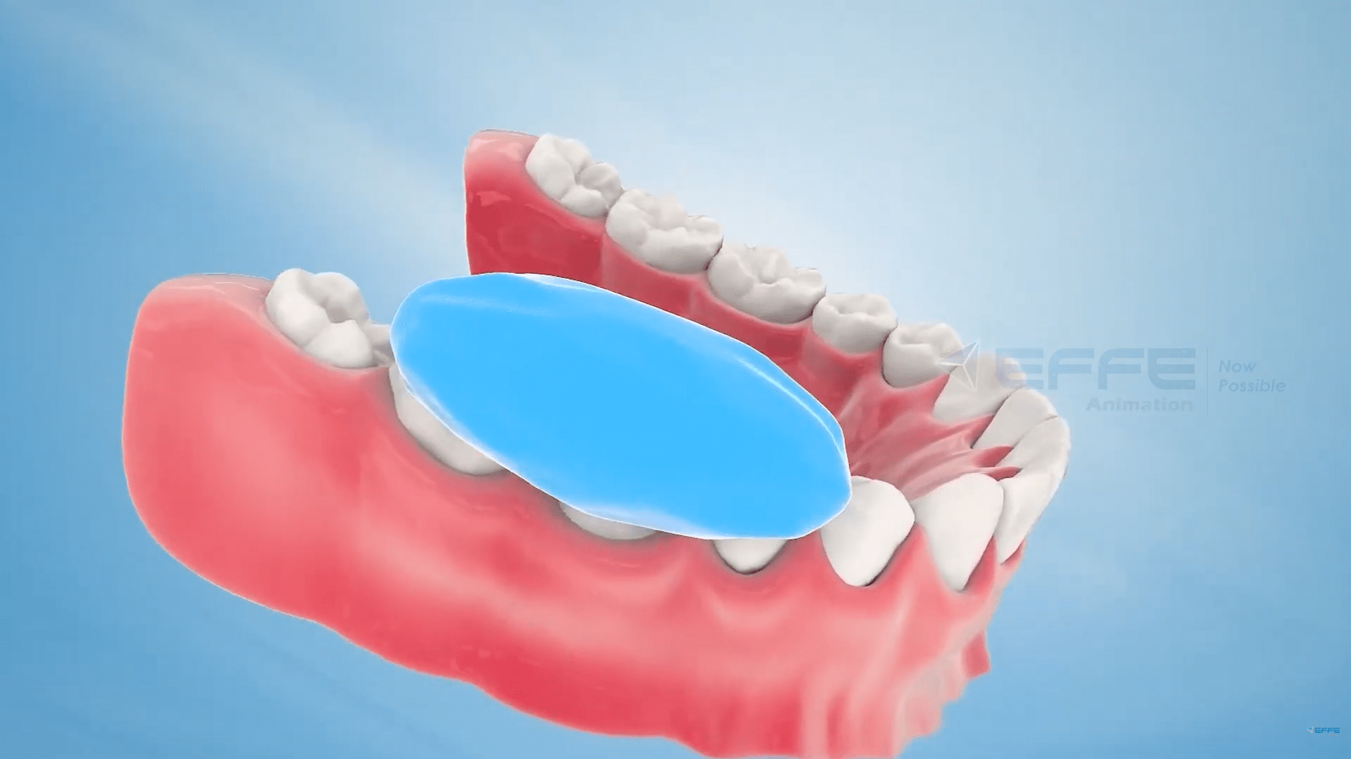 dental application animation 