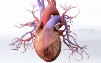 Cardiovascular Mechanism Animation: Visualizing Coronary Artery Disease