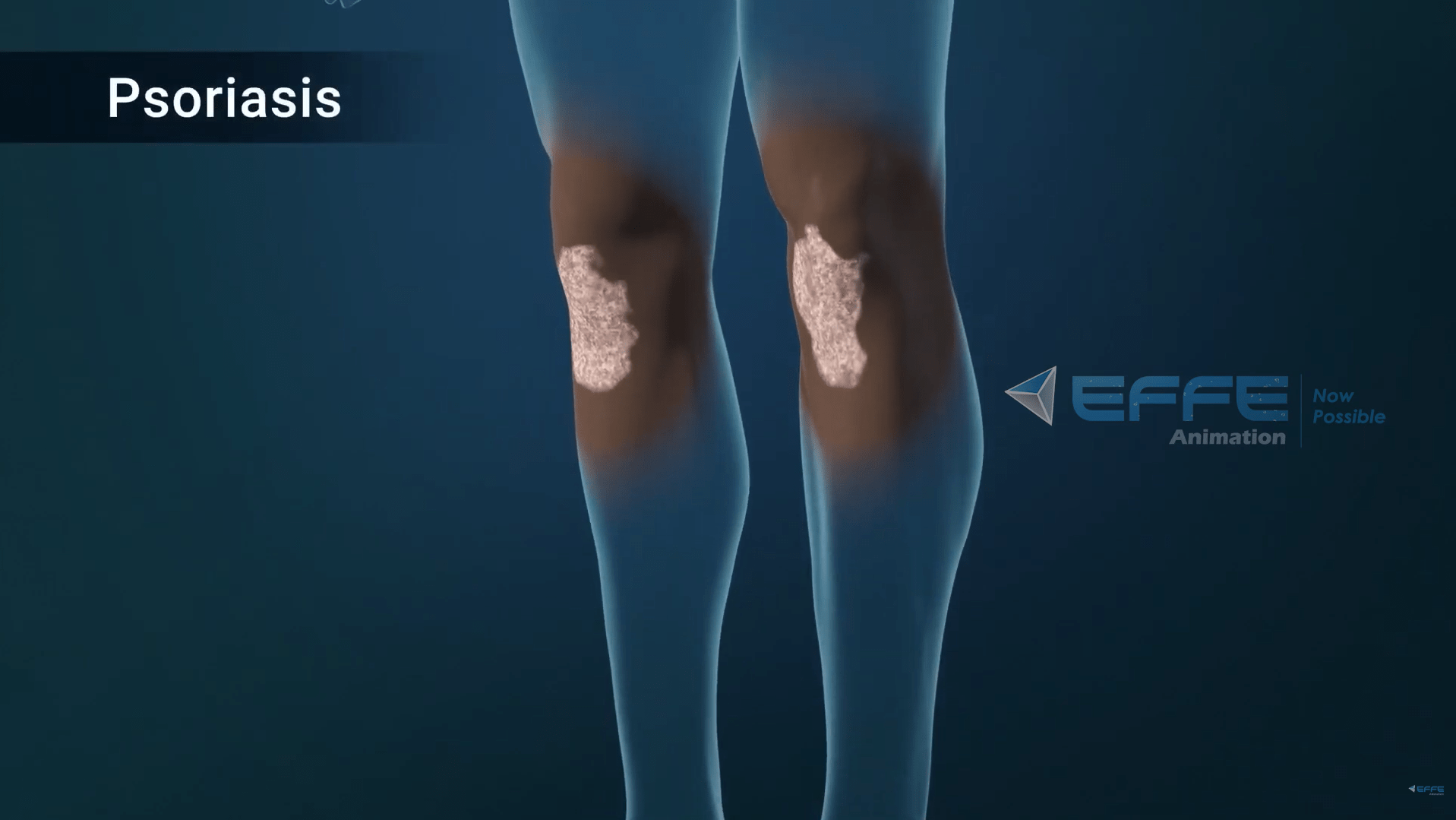 Dermatological Disease Mechanism animation