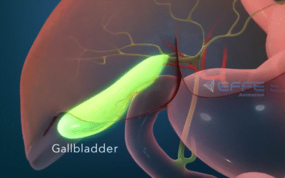 3D Animation of Laparoscopic Surgery for Medical Education
