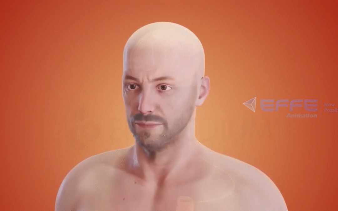 Surgical Device Animation – Step-by-Step Visualization of Deep Brain Stimulation