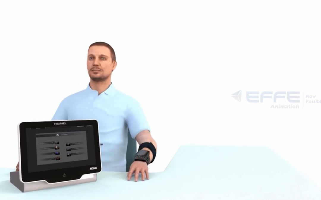 3D Medical Visualization of Blood Pressure Monitor – Monitoring Devices for Healthcare