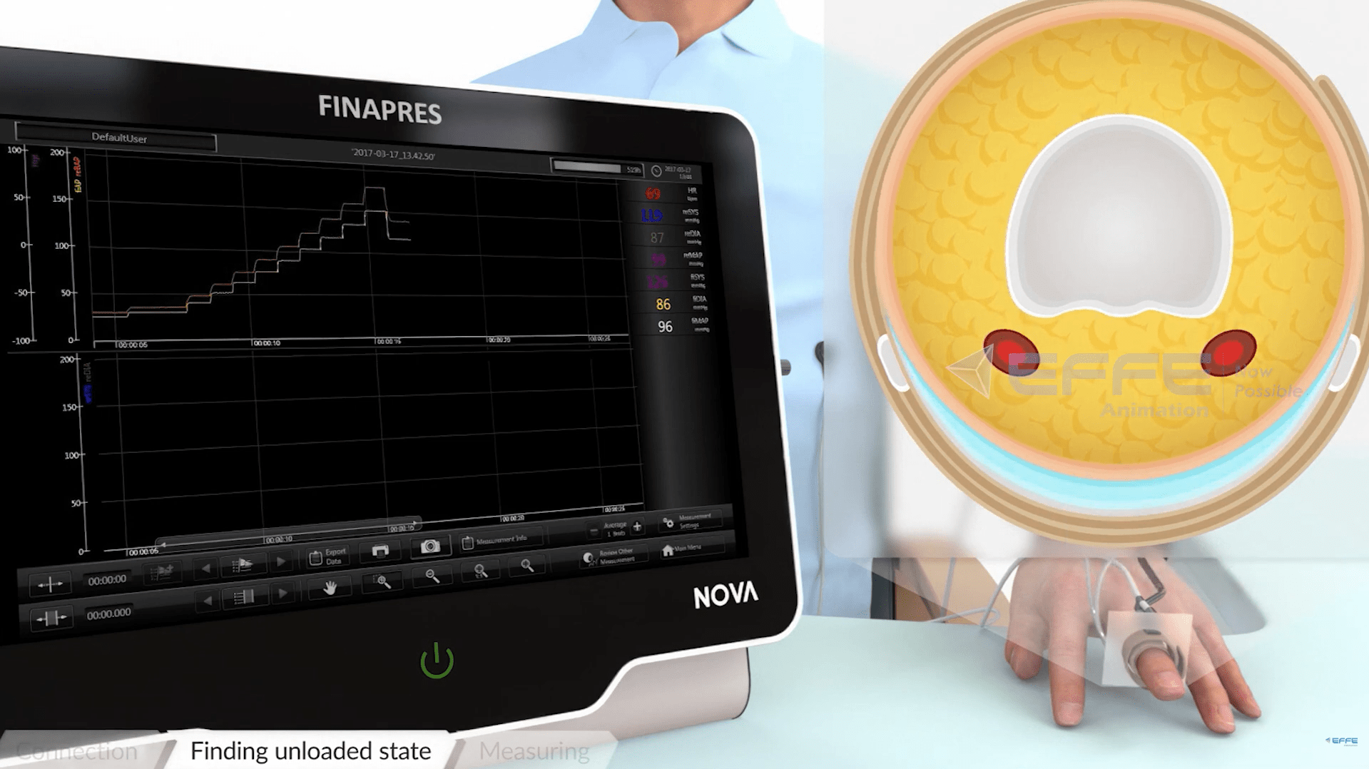 monitoring devices animation 