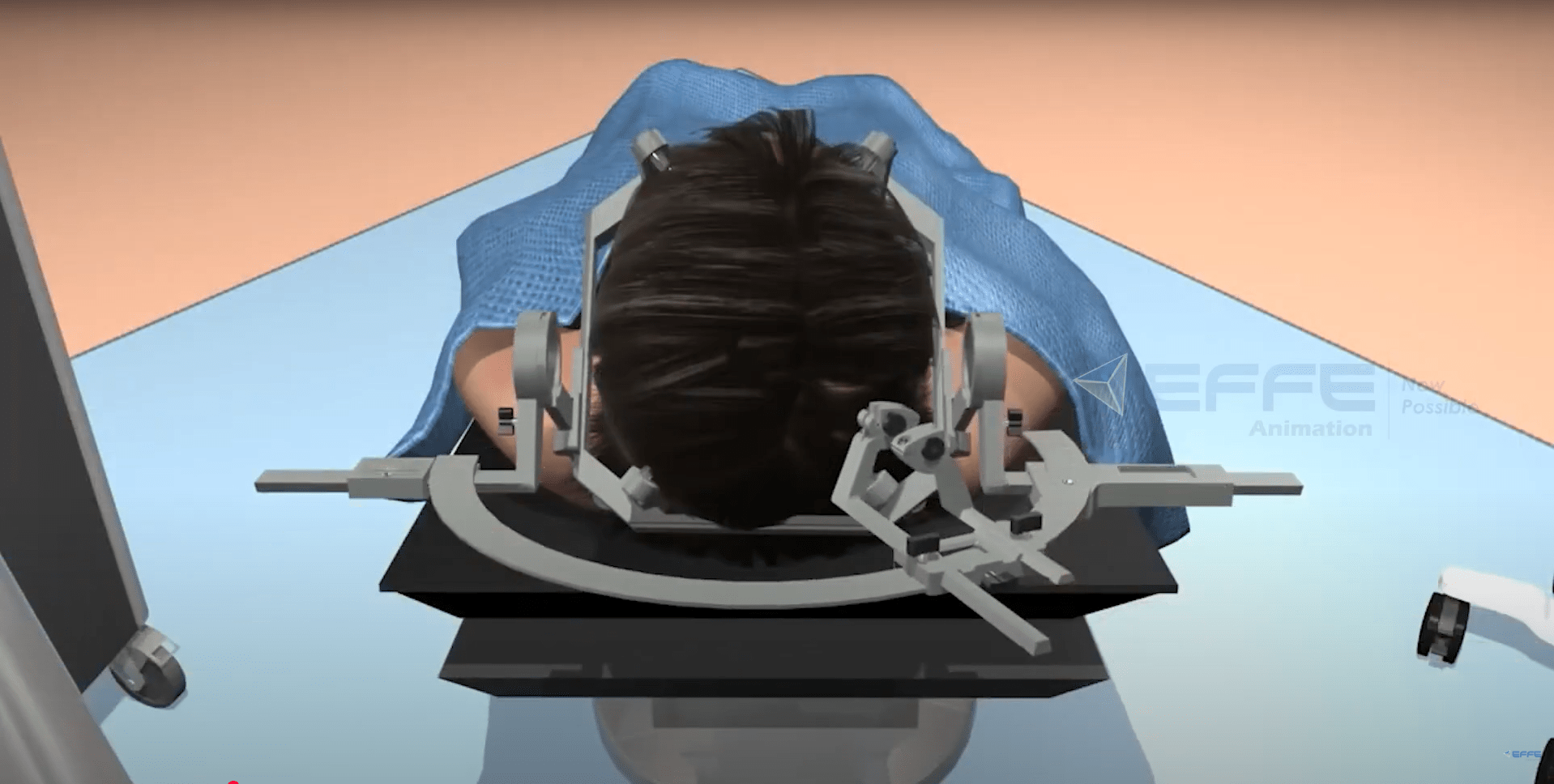 Brain Surgery device