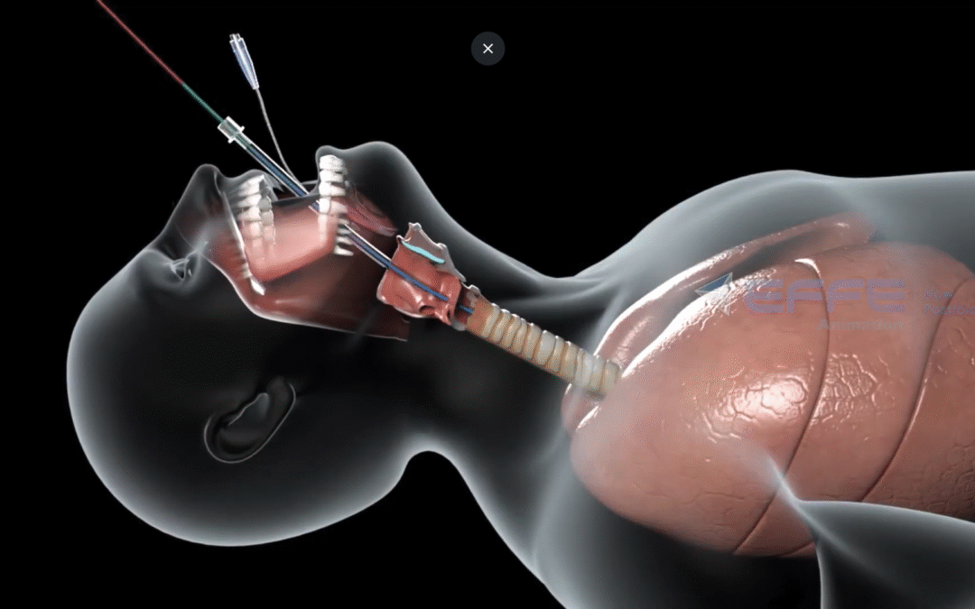 Step-by-Step Direct Laryngoscope Bio Medical Device Animation for Medical Training