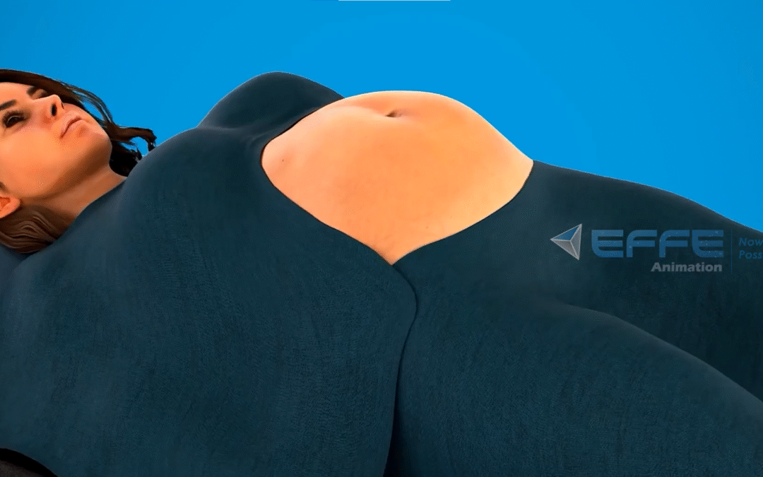 3D Cesarean Section Animation – Step-by-Step C-Section Procedure
