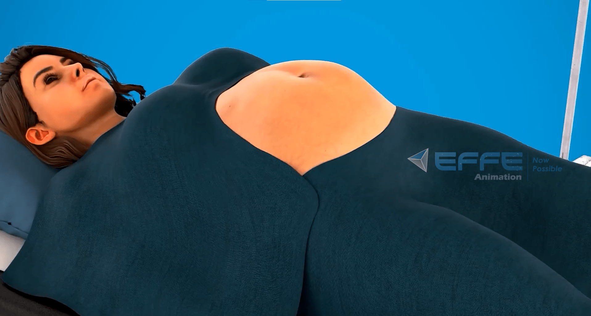 cesarean section animation