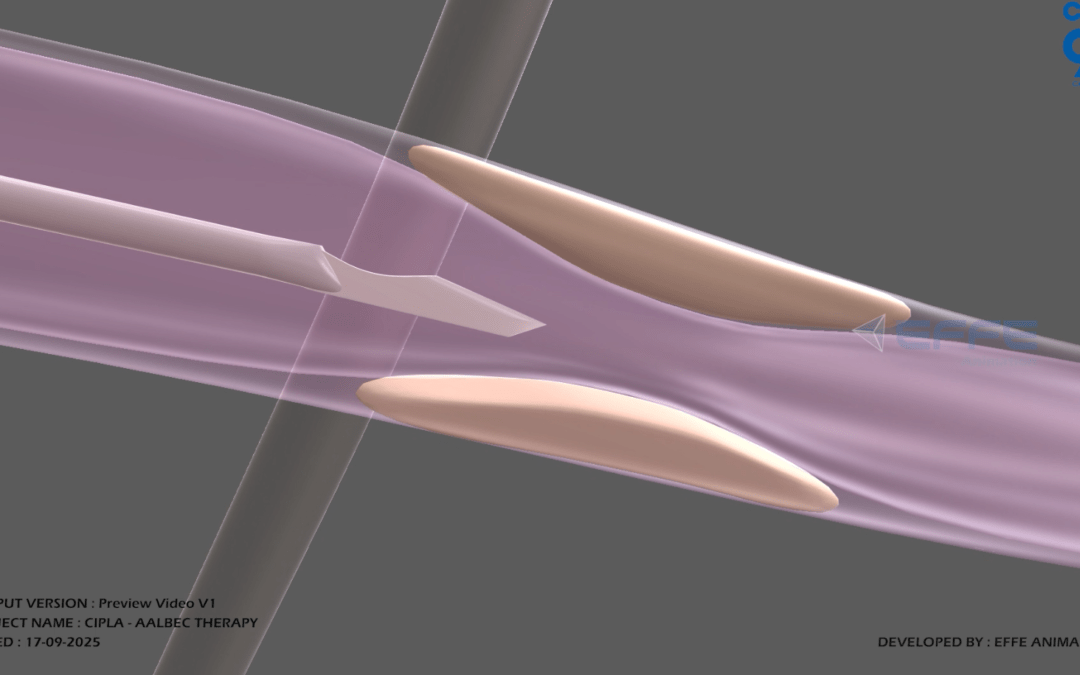 3D Medical Animation for Urologic Surgery Education | 3d Medical Animation