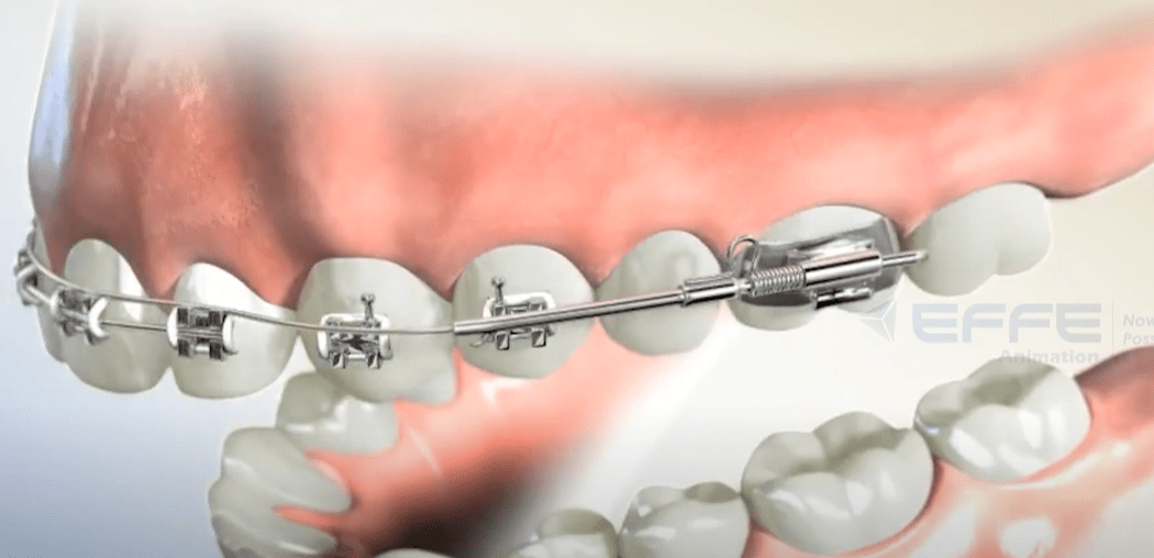 Dental animated video