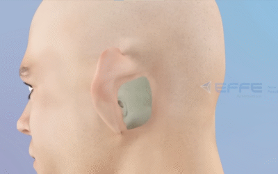 3D Medical Animation for Otolaryngologic Surgery – ENT Surgical Training & Patient Education