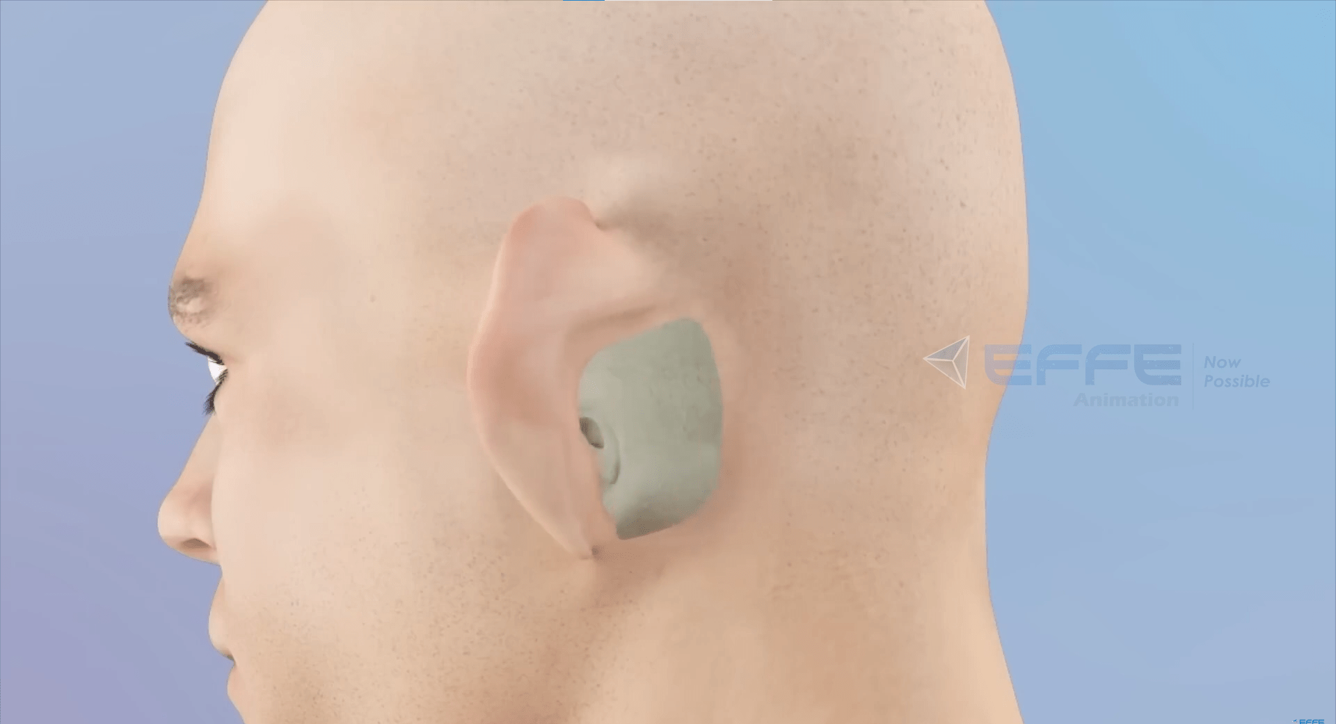 Otolaryngologic Surgery animation